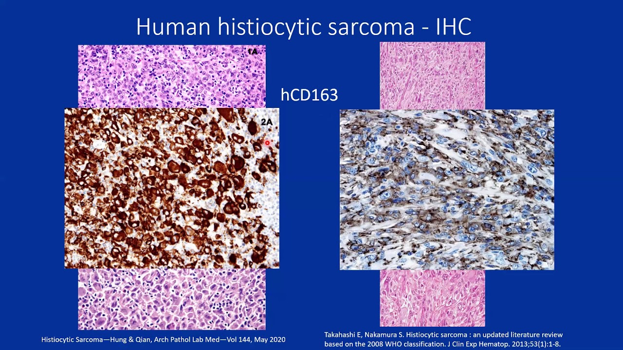 Laura Janke Presents Histiocytic Sarcoma in Mice || Academy of Genomic Pathologists Rounds 2.25.21
