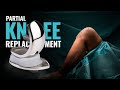 Partial Knee Replacement by Zimmer Biomet