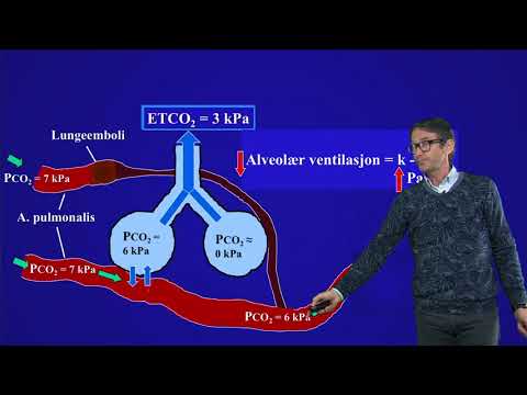 Video: Forskjellen Mellom Anatomisk Og Fysiologisk Dødrom