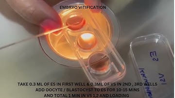 OOCYTE/EMBRYO VITIFICATION
