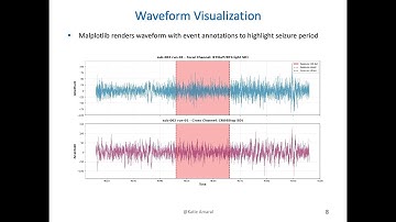 Harvard Extension CSCI-E89 Final Project Deep Learning Seizure Detection with SeizeIT2 dataset