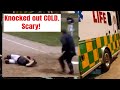 Horrible Baseball Injury!  Ambulance called. Trip to ER