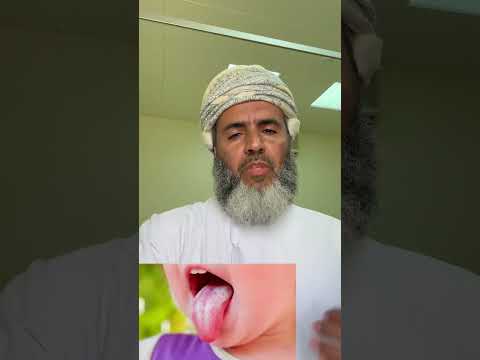 هل تعاني من تقرحات في الفم أو اللسان اكسبلور ترند