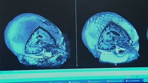 New book aims to help people understand the vegetative state