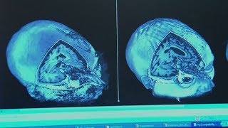 New Book Aims To Help People Understand The Vegetative State