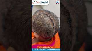 Successful Recovery After Brain Haemorrhage Surgery | Gold Medalist - Dr. Prashant Yadav