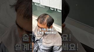 남자 탈모커버, 볼륨이 먼저 입니다. #남자머리#탈모펌#탈모커버#링거펌#숱없는머리#정수리탈모#대구미용실#헤어315