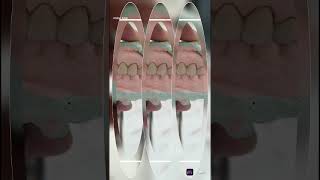 photo challenge dental 🪥 Lab technician Sajid please 🙏 like comment subscribe and share......