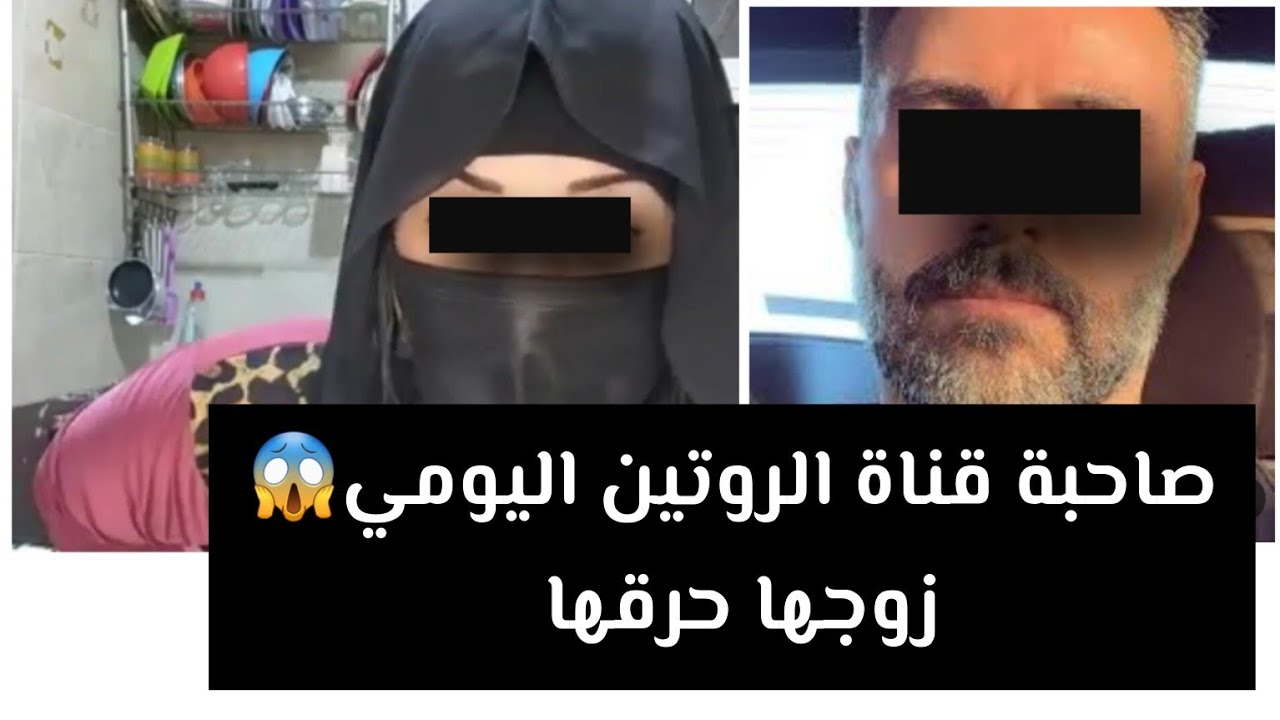 صاحبة قناة الروتين اليومي 😱 زوجها حرقها 👉 قصة حقيقية ‼