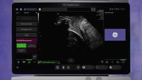 GE Voluson™ Club   Learning Library   Voluson SWIFT Labor & Delivery Tech Tips 2021