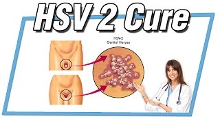 hsv 2 cure 2016(, 2016-06-18T10:22:47.000Z)