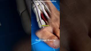 🦶🔧 Исправление косточки на ноге у хирурга!