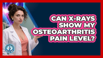 Can X-Rays Show My Osteoarthritis Pain Level?