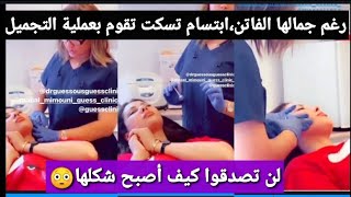 ابتسام تسكت تقوم بعملية التجميل و تغير شكل وجهها شاهدو كيف أصبحت،?