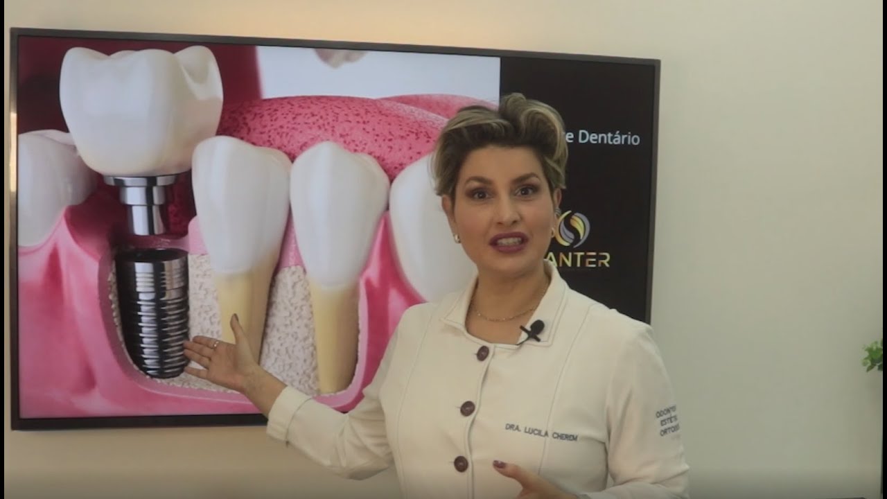 Implante dentário pode ser rejeitado pelo organismo?
