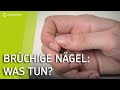 Das solltest Du über Deine Nägel wissen | Brüchige Fingernägel und Nägelpflege