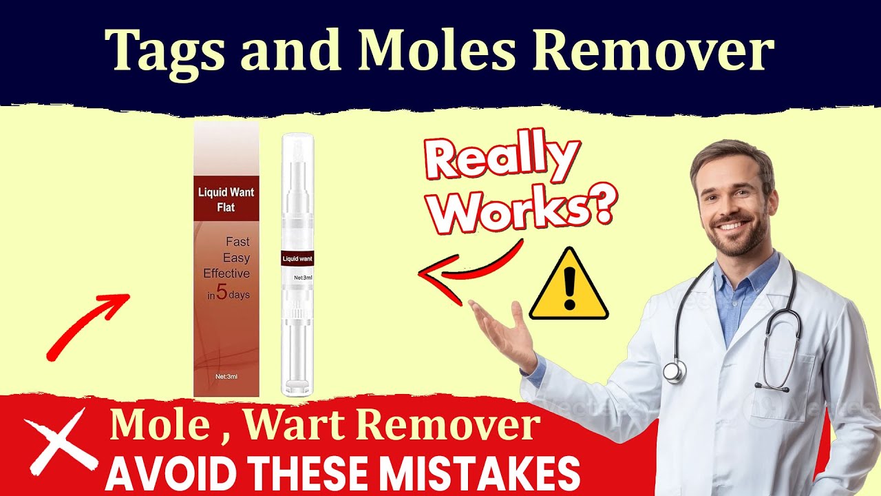 Tags and Moles Remover Device Review - Legit or Scam Product?