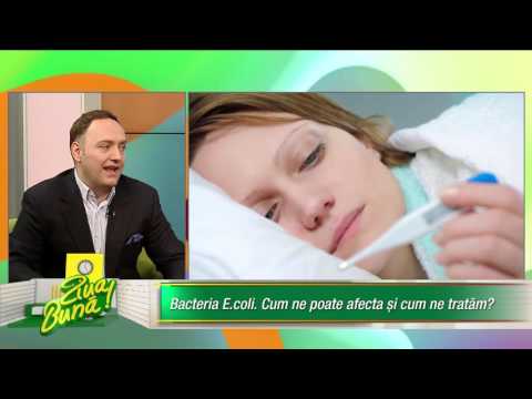 Video: Febra Tifoidă - Simptome, Diagnostic, Prevenire. Agentul Cauzal Al Febrei Tifoide