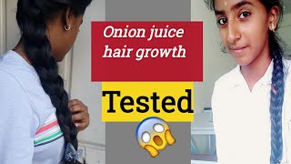 Tested Onion juice for hair growth?||how to use onion juice|| treat hair growth and dandruff