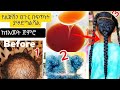 ፀጉር በእጥፍ ያሳድጋል ፀጉርሽ እየረገፈ እያሳከከሽ አየሳሳ ከሆነ አሁኑኑ መጠቀም ጀምሪ 