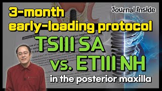 Journal Inside Comparison Of Sa And Nh Implants With 3-Month Early Loading Ai Voice-Over