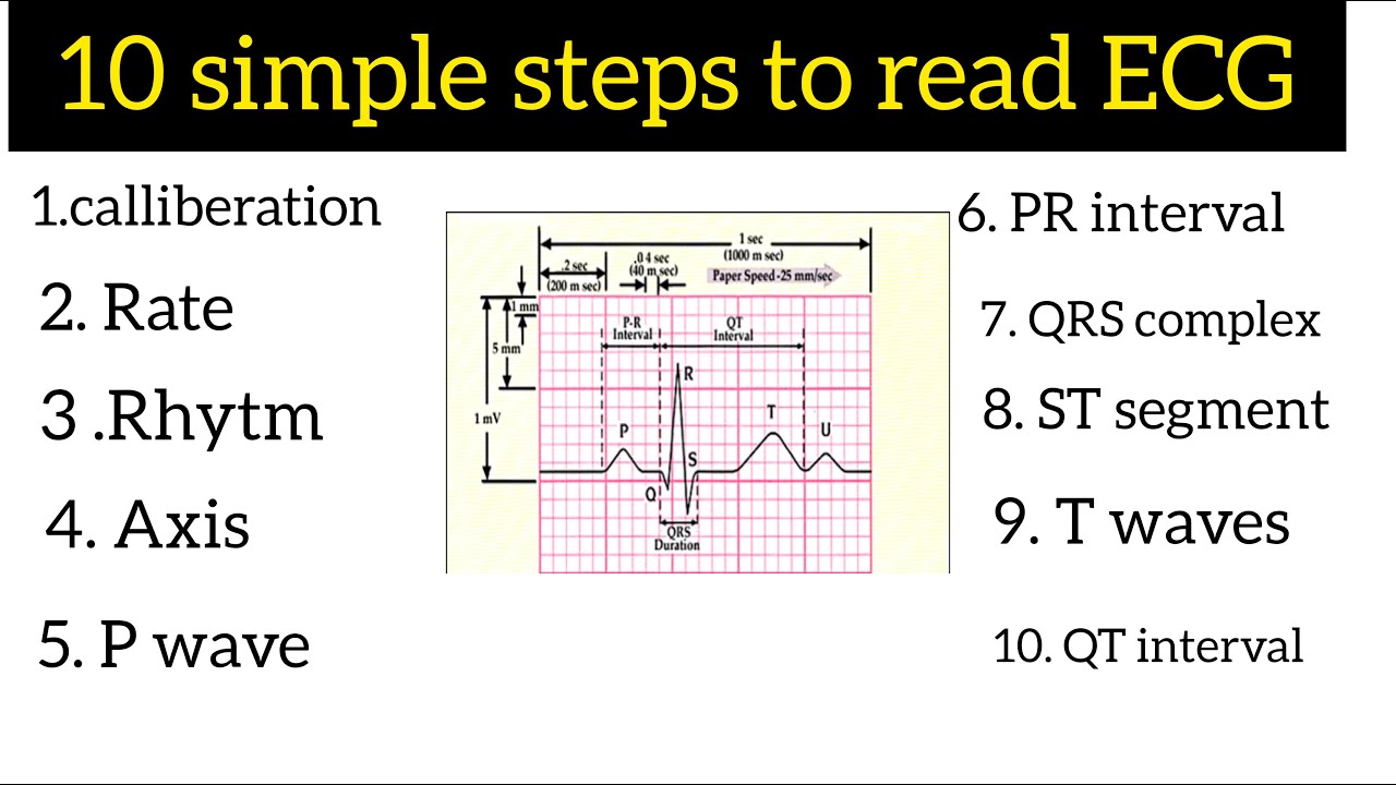 HOW TO READ ECG |ECG BASICS | ECG| EKG - YouTube