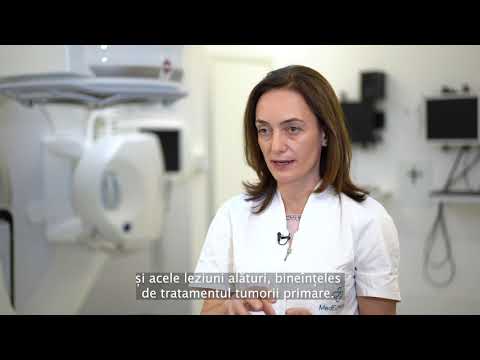 Radioterapia în metastazele osoase - Dr. Diana Ratea