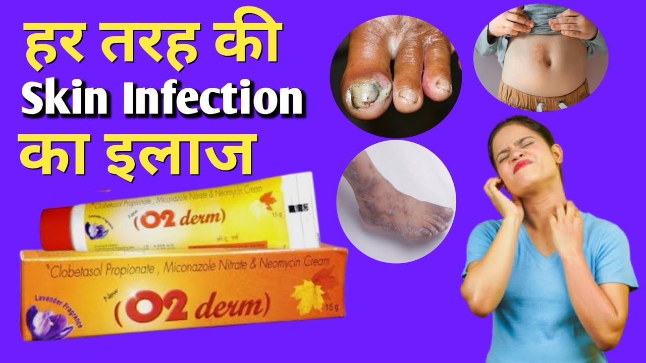 जानिए O2 Derm Cream के फायदे और नुकसान कब और कैसे लगाना चाहिए