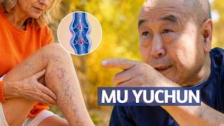 Varicose Veins and Other Leg Problems. Mu Yuchun. Part 1