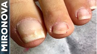 Частичный педикюр / Покрытие ногтей гель лаком