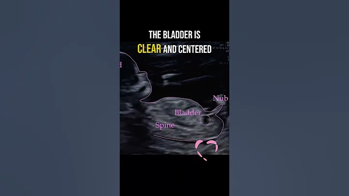 Gender reveal with NubX!