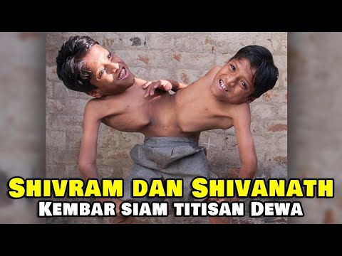 Video: Kembar Siam India Shivanath Dan Shivram - Pandangan Alternatif