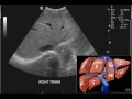 Introduction to the interpretation of abdominal ultrasound