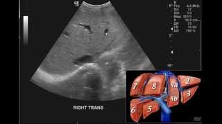 Introduction to the interpretation of Abdominal Ultrasound