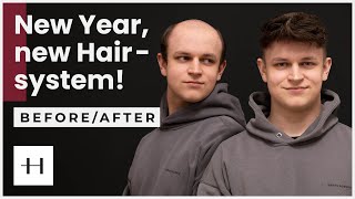 From 0% to 100% Volume in only 2 Hours! Hairsystem Transformation by Heydecke