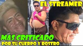 SIDERAL SE HARÁ 14 OPERACIONES EN EL ROSTRO,BARRIGA Y SU MICROM13MBRO, HISTORIA DE SU transformación