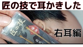 甥っ子の耳かき３　ear cleaning　匠の技で耳かきしました。2021年9月5日