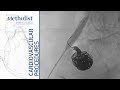 Coiling and Stent Grafting of Internal Iliac Aneurysm (Alan B. Lumsden, MD, Ross G. McFall, MD)