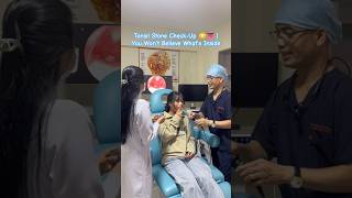 Tonsil Stone Check-Up 😳👅 | You Won’t Believe What’s Inside #ThroatCare #Medical #Viral