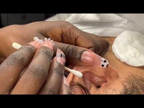 ASMR RARE and Specific Ear Picking | Cleaning Wax & Whitehead removal 💆🏻‍♂️