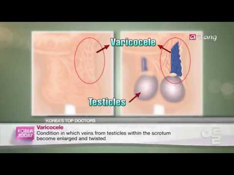 arirang-tv-issue_-urology-spcialist-in-treatment-varicocele-_남성난임-정계정맥류-권위자-제일병원-서주태-교수