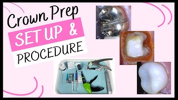 TRADITIONAL CROWN PREP SET UP & PROCEDURES // Tips For Dental Assistants