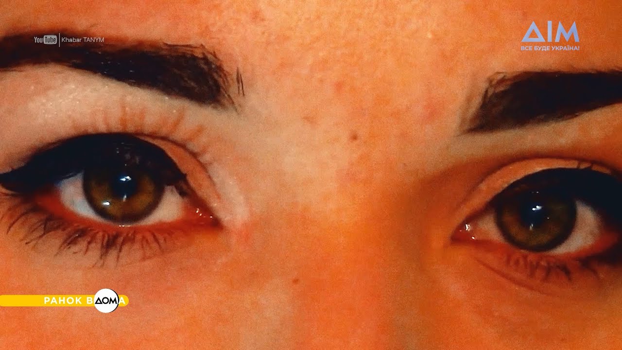 Глаукома: як захиститися від хвороби? - YouTube