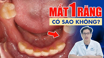Mất 1 Răng Có Sao Không? Có Cần Trồng Lại Không? Bác Sĩ Giải Thích Chi Tiết