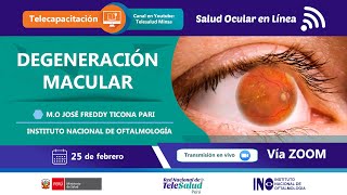 DEGENERACIÓN MACULAR