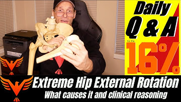 Increased Hip External Rotation - What Causes Extreme ER? - BillHartmanPT.com Q&A for The 16%
