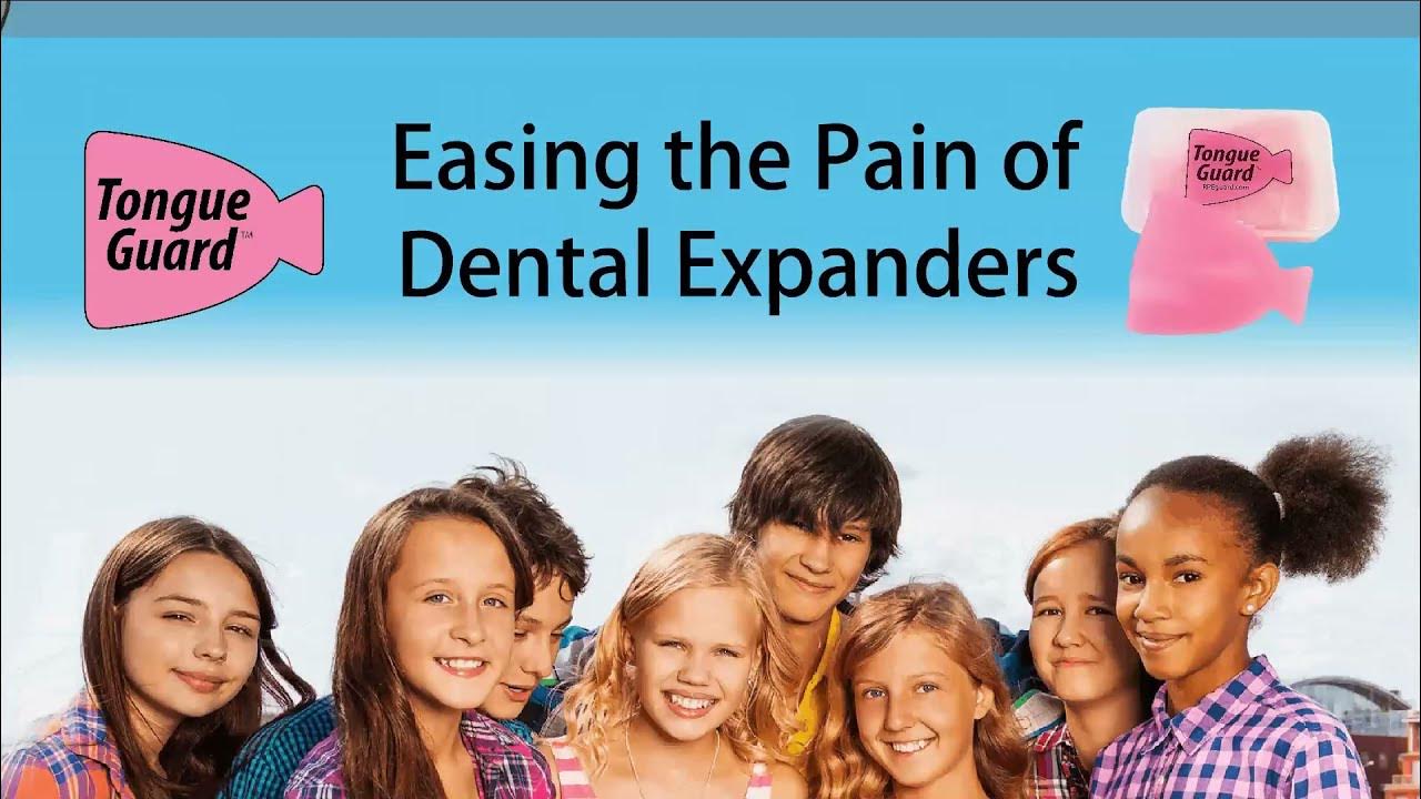 Tongue Guard Help Prevent Tongue Sores From Dental Expanders/RPE. It Also Helps Heal & Relives