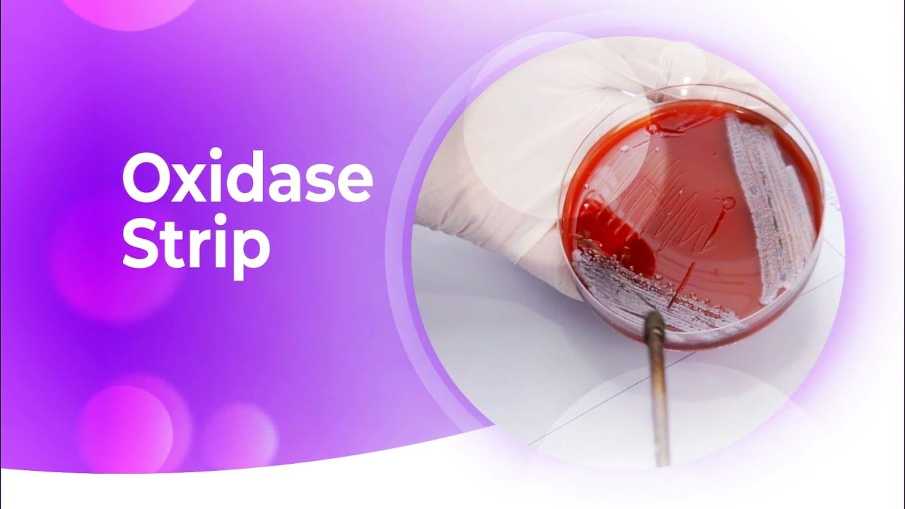 Oxidase Strip YouTube