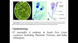 Penicillosis I Opportunistic infections I Mycotoxicosis I Medical mycosis I Medical microbiology