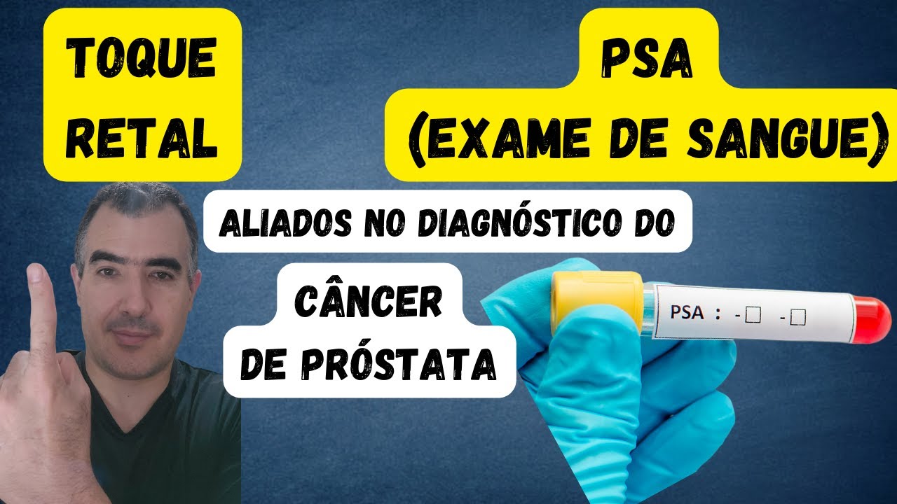 esame psa prostata costo y